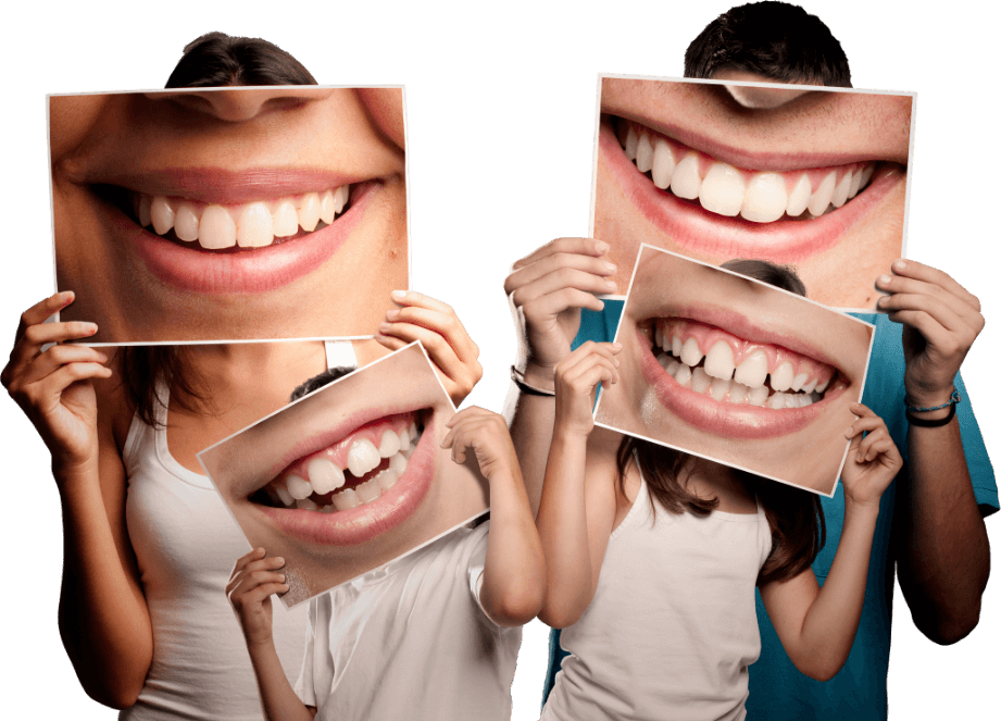 smile-make-over