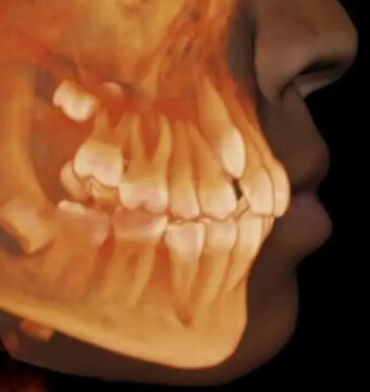 CBCT-scanner