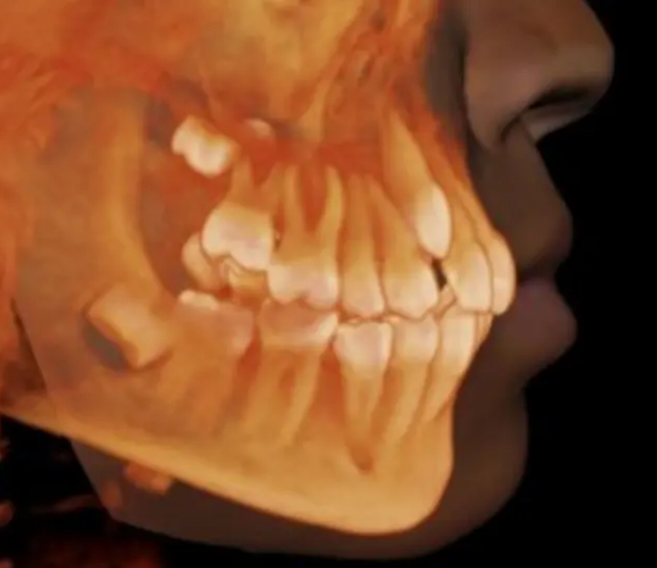 cbct-scanner-1