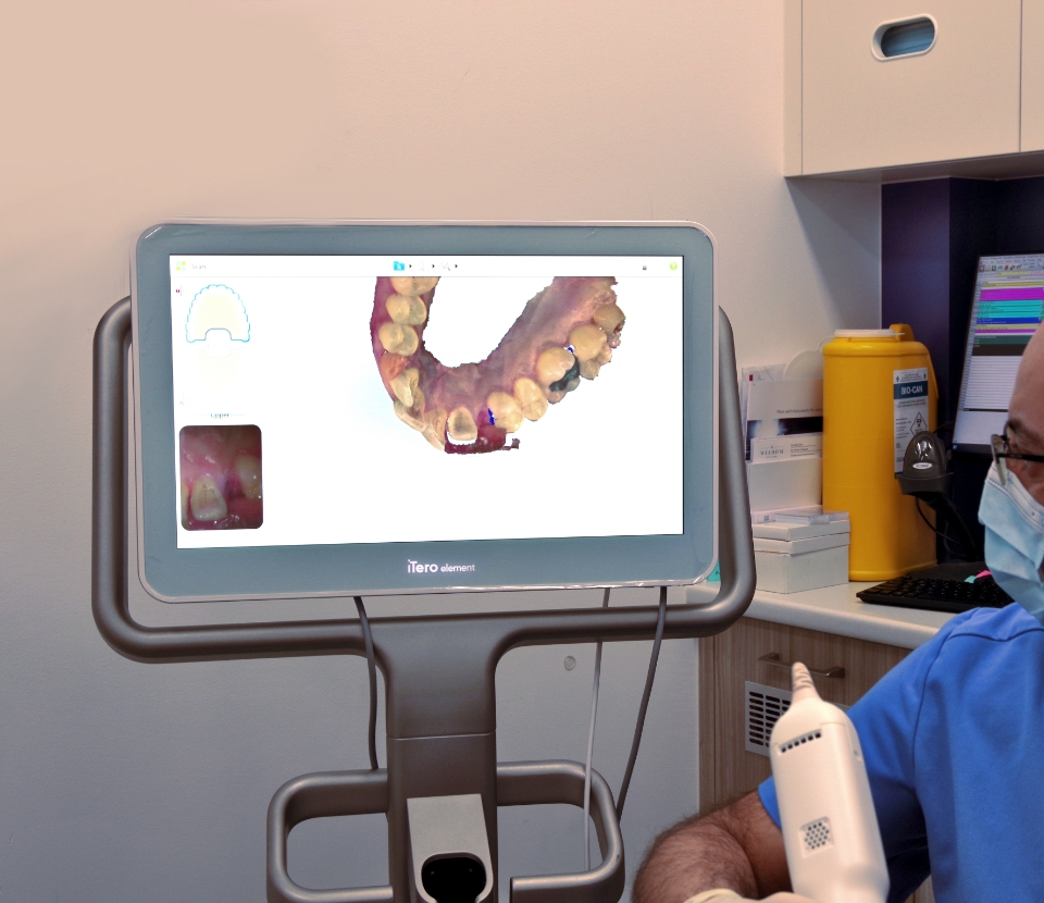 dental-monitoring-2