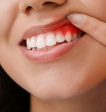 gum-disease