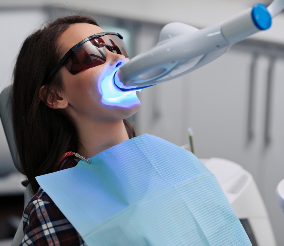 teeth-whitening-1